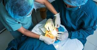 Free Eye Camp Kalamassery