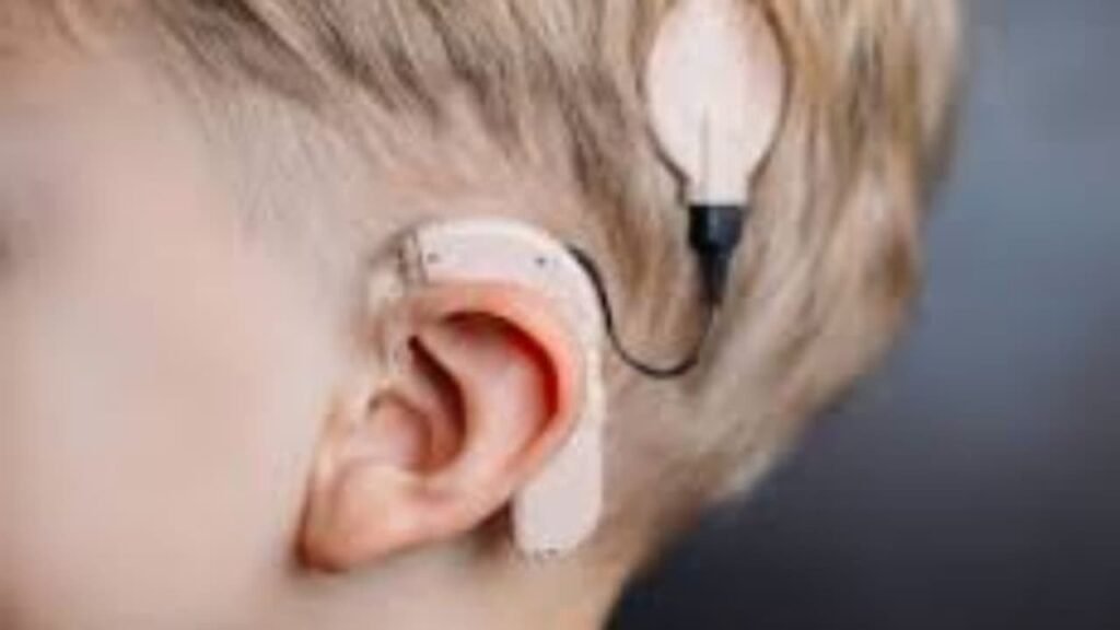 Free Cochlear Implantation Kerala
