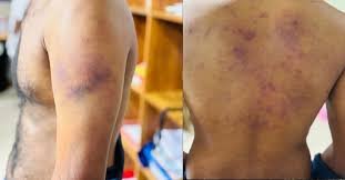 Kochi Honey Trap Assault Case