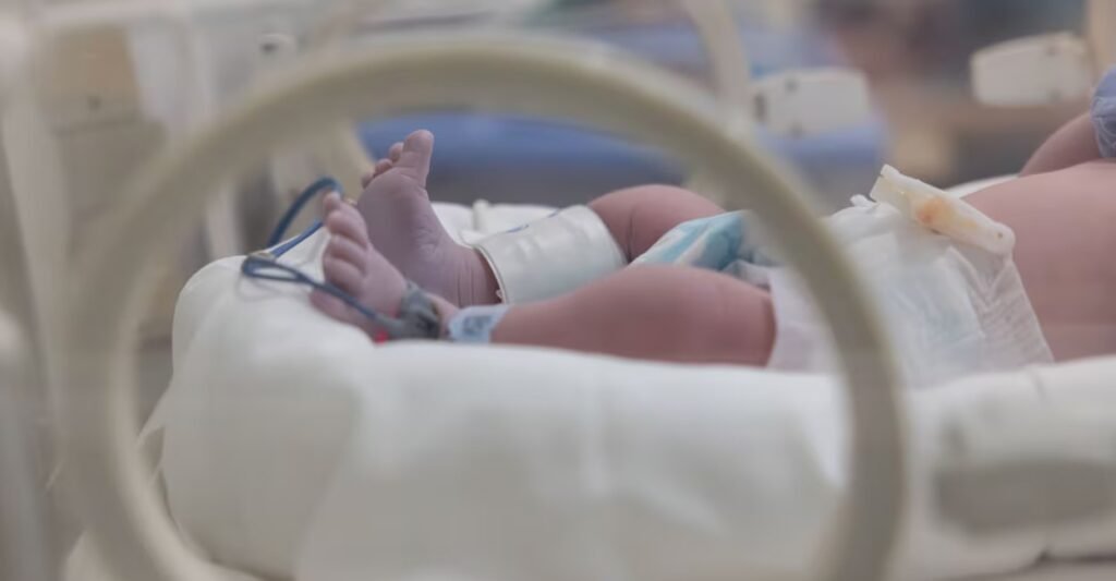 Persistent Pulmonary Hypertension of the Newborn