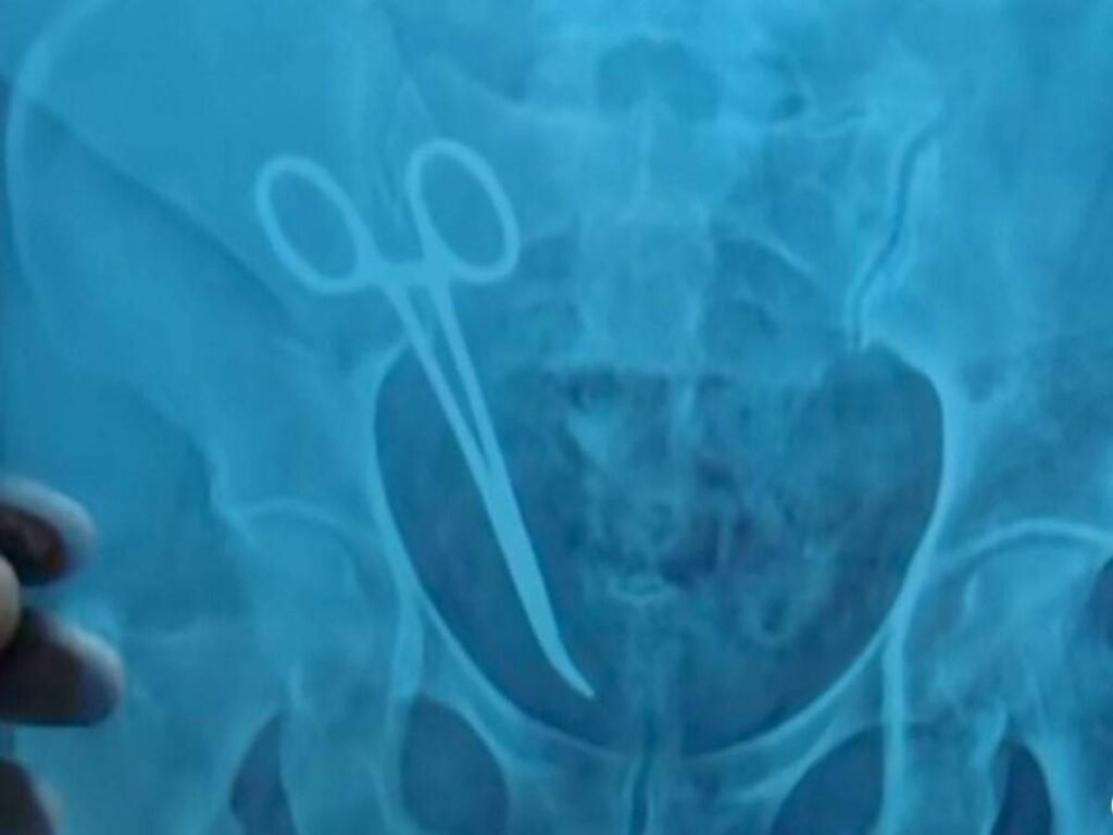 Kerala Surgical Negligence Controversy